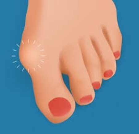 Zobrazit produkty v kategorii Hallux Obrázek pro kategorii Hallux